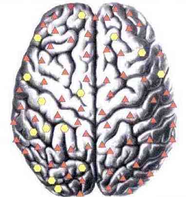 mozak